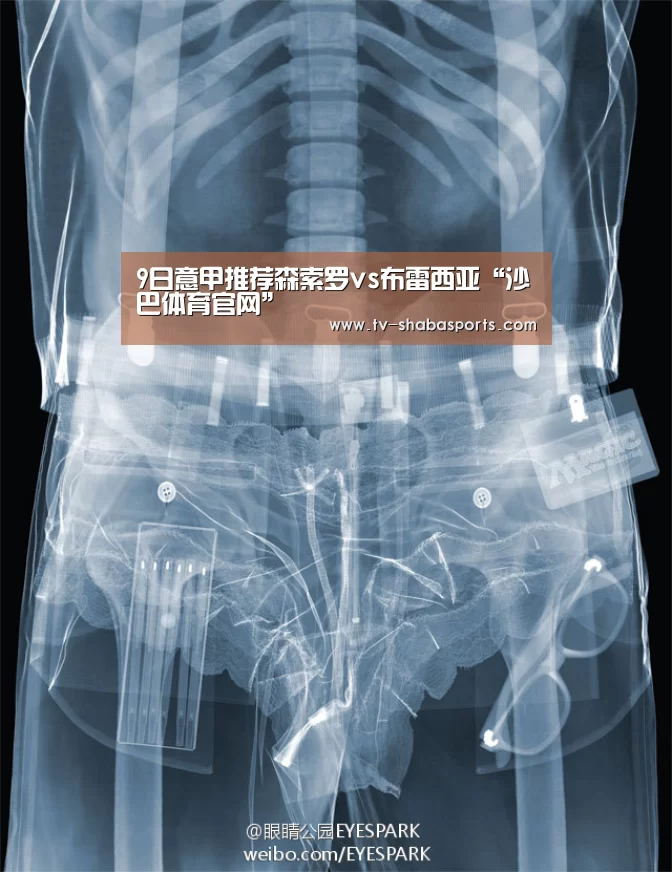 9日意甲推荐森索罗vs布雷西亚“沙巴体育官网”(图3) 沙巴体育平台